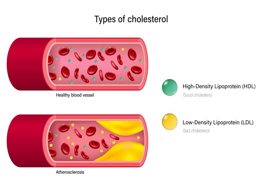 colesterol HDL e LDL