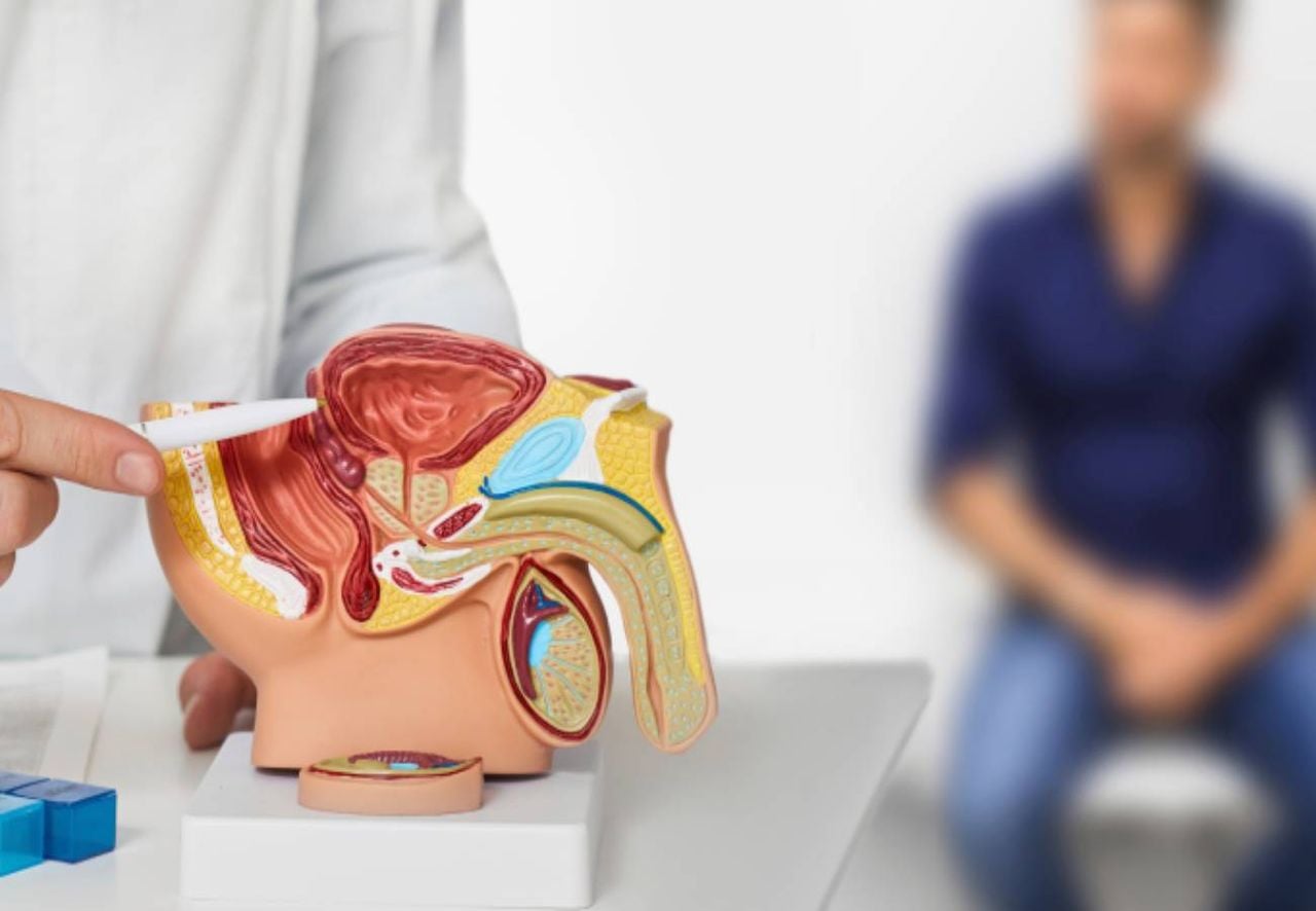 En Brasil, el cáncer de próstata es el segundo más frecuente entre los hombres, sólo superado por el cáncer de piel no melanoma.