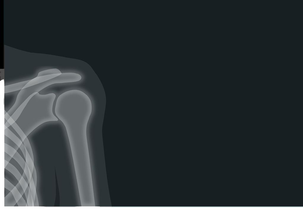 Radiografia Radiografia