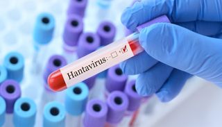 Hantavirus Cases Rise to 11 as Officials Warn the Number Could Rise—Find More Details Here