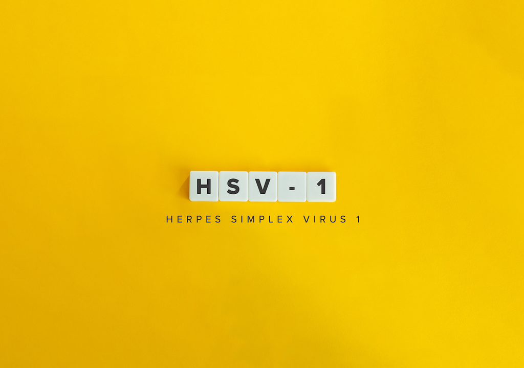 Erwachsenen, Deutschland, Herpes-simplex-Virus Typ 1, HSV-1, infiziert, Symptome Erwachsenen, Deutschland, Herpes-simplex-Virus Typ 1, HSV-1, infiziert, Symptome