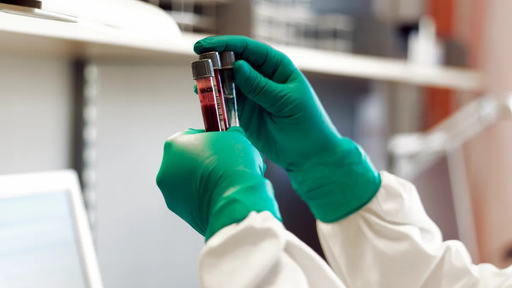 Una aplicaci&oacute;n m&aacute;s de la IA: proporcionar una hora de la muerte m&aacute;s precisa, crucial para investigaciones forenses