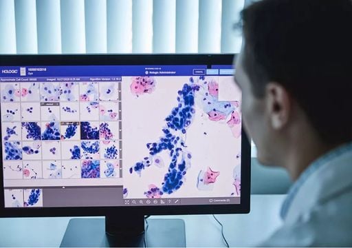 Hospital de &Eacute;vora &eacute; o primeiro em Portugal a usar IA para detetar cancro do colo do &uacute;tero