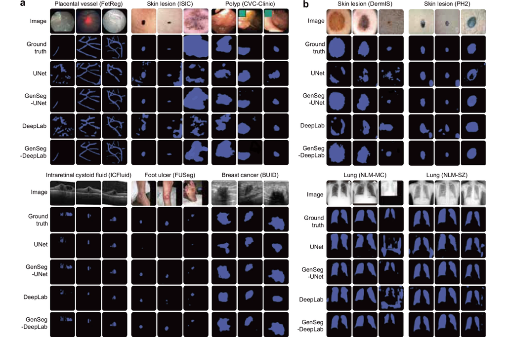 Pesquisadores criam modelo de IA que ajuda médicos a diagnosticarem mais rápido e com melhor performance. Crédito: Zhang et al. 2025
