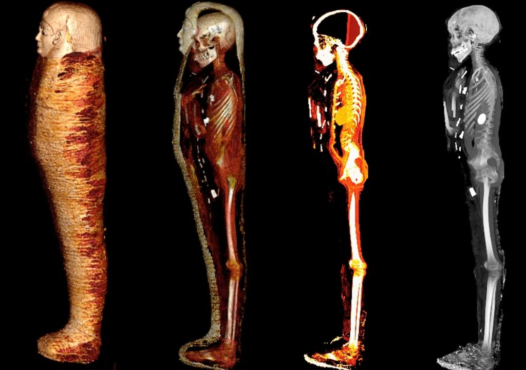 Des images de tomographie révèlent l'intérieur du "Golden Boy", momifié il y a 2 000 ans. Source : Université du Caire.