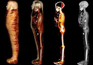 Imágenes revelan misterios del "niño de oro" momificado hace 2300 años