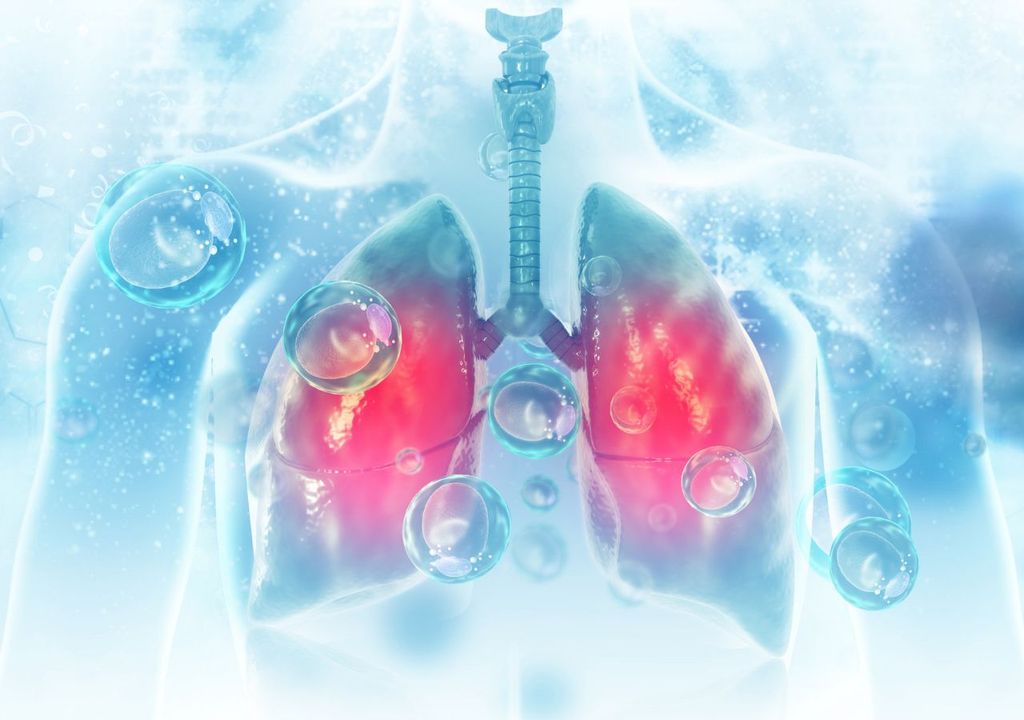 Infección pulmonar