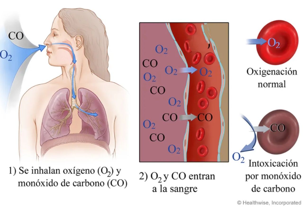 muerte por envenenamiento por monóxido de carbono