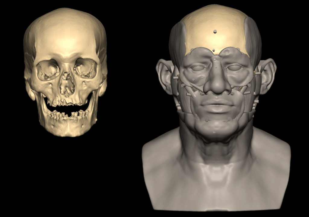 reconstrucción facial reconstrucción facial