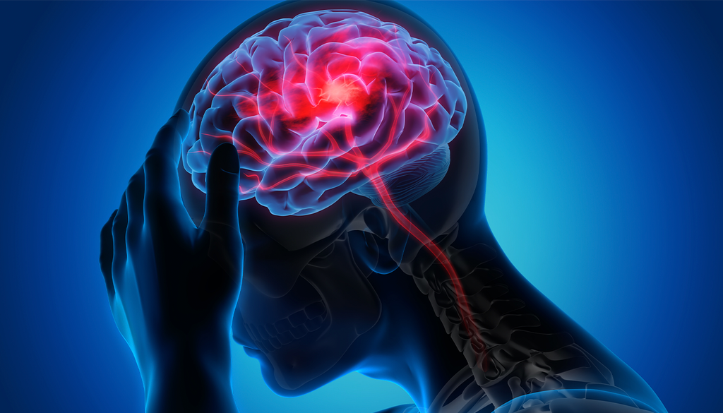 Cervello. Hanno rilevato una correlazione tra l'emicrania e la frequenza degli episodi di "congelamento cerebrale".