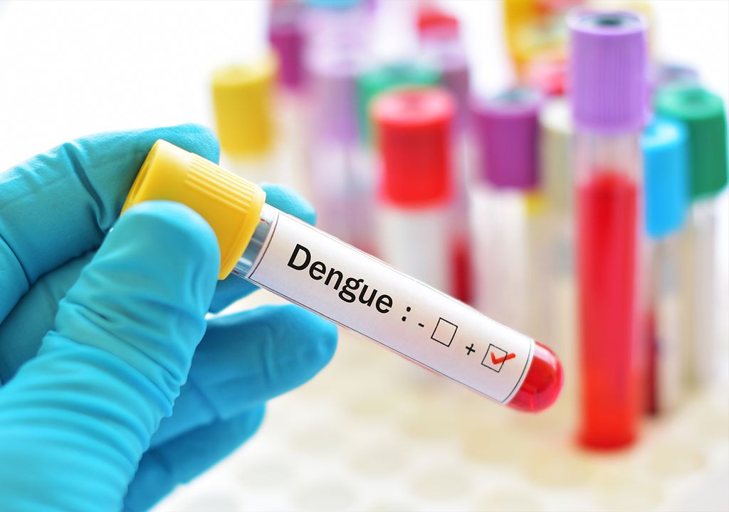 Dengue y zika