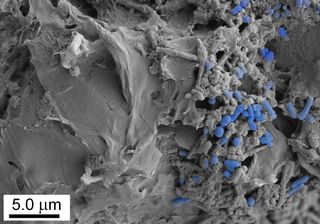 La ingesta de microplásticos altera la microbiota intestinal humana