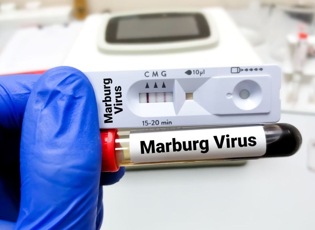 El virus de Marburgo no es nuevo, fue identificado en 1967