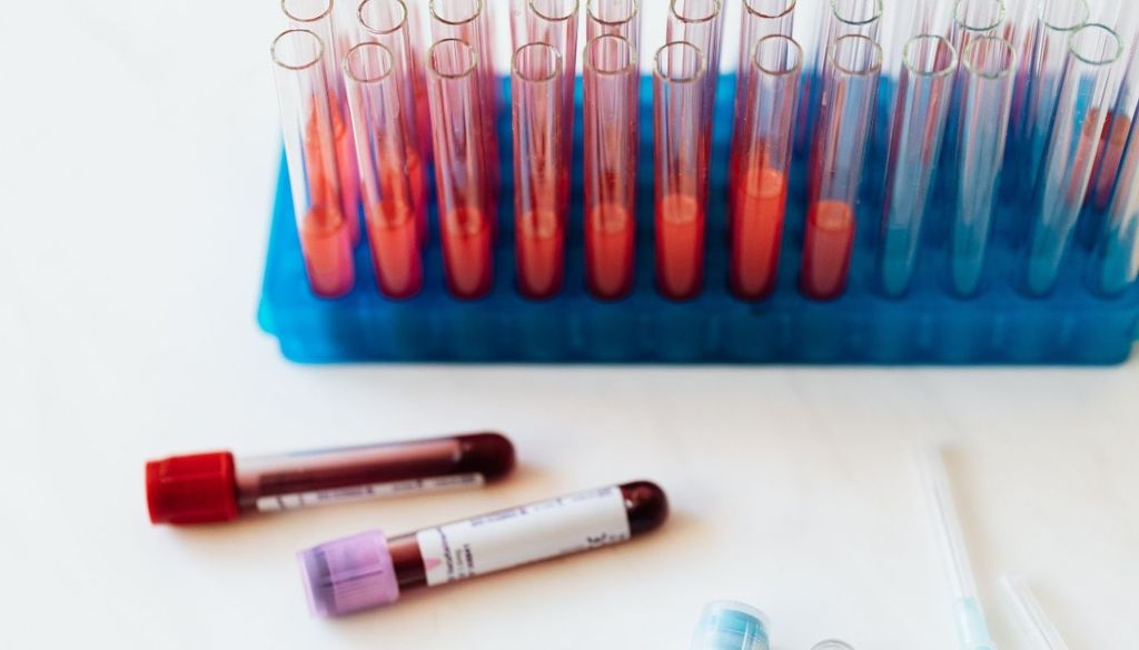 La infección bacteriana, causada por el Treponema pallidum, puede permanecer en el cuerpo durante años sin mostrar síntomas evidentes.