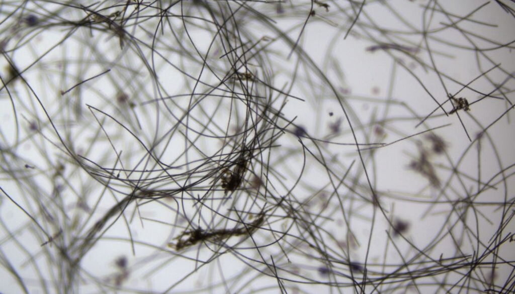 Imagen microscópica de filamentos de cianobacterias, microorganismos capaces de proliferar rápidamente cuando encuentran condiciones favorables en el agua. Crédito: Universidad de Chile. Imagen microscópica de filamentos de cianobacterias, microorganismos capaces de proliferar rápidamente cuando encuentran condiciones favorables en el agua. Crédito: IFOP.