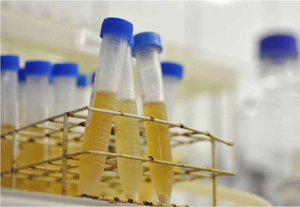 tubos con muestras de agua recolectada