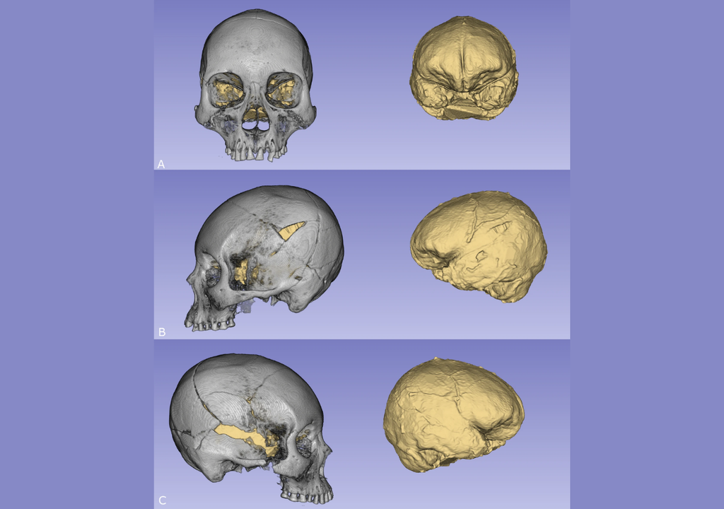 Reconstrucciones tridimensionales por tomografía computarizada de cráneos Chinchorro (en gris) y sus respectivos moldes intracraneales (en amarillo), donde se observan fracturas y discontinuidades en regiones frontal y temporal. Estas imágenes permitieron estimar el volumen cerebral sin dañar los restos. Fuente: Rojas-Costa et al., 2025, Scientific Reports.