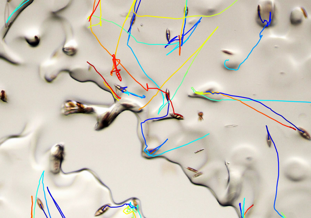 Die Forscher entwickelten und verwendeten spezielle Mikroskope und Versuchsumgebungen, um zu verfolgen, wie sich die Kieselalgen durch das Eis bewegen. Bild: Prakash Lab