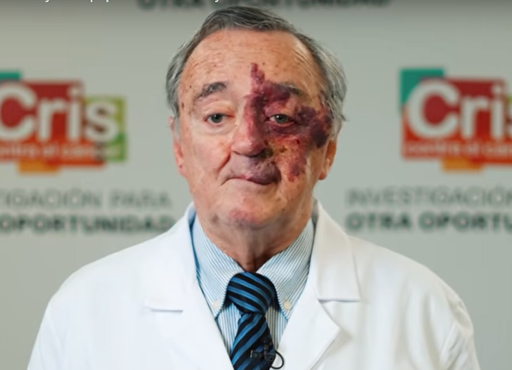 &iexcl;Hito m&eacute;dico! Equipo de Mariano Barbacid, logra eliminar el c&aacute;ncer de p&aacute;ncreas en laboratorio