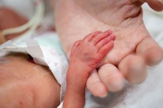 Llaman a padres de familia de bebés prematuros a exigir el tamiz oftalmológico a las cuatro semanas de nacer su bebé