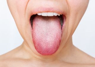 Lo que tu lengua quiere decir: cómo es una lengua sana y qué signos podrían indicar problemas de salud