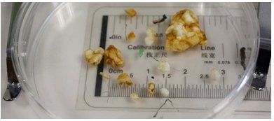 Los Microplásticos También Contaminan Nuestros Suelos Los Microplásticos También Contaminan Nuestros Suelos