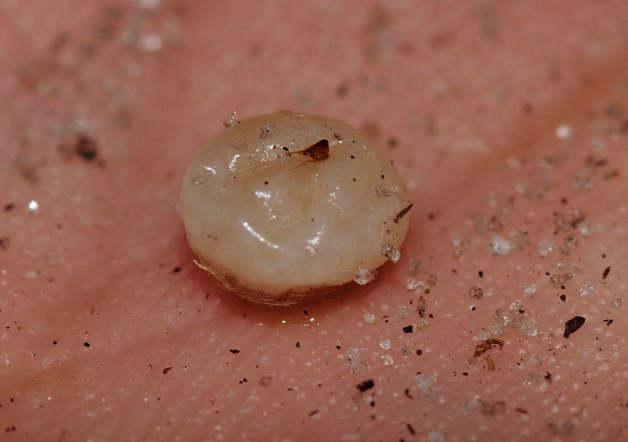 Os parasitas mais estranhos que podem invadir o corpo humano