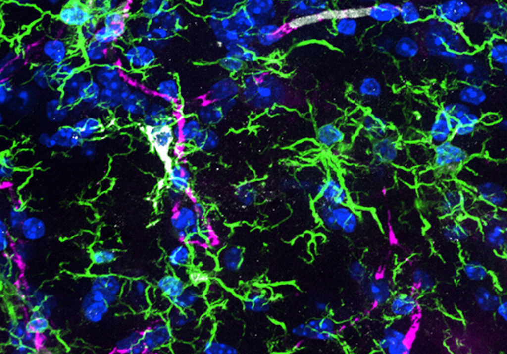 Microglia nel cervello