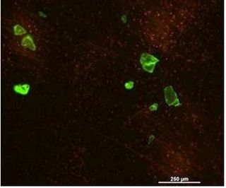 Microplásticos perdidos: detección