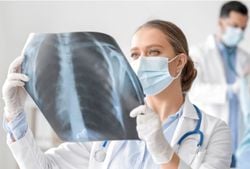 Aumento en el mundo de una nueva variante de influenza