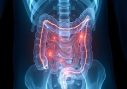 Equipa portuguesa descobre acidentalmente bactéria que trava infeções no intestino