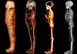 Imágenes tomográficas revelan misterios del "niño de oro" momificado