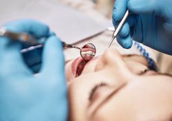 En Inglaterra, se está animando a los dentistas a utilizar menos óxido nitroso para proteger el clima