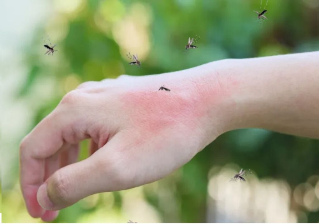 mosquitos alergia