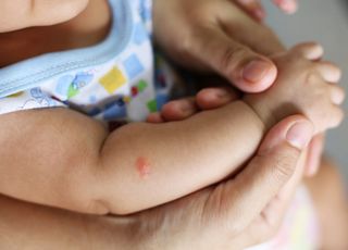 Moustique : comment protéger son bébé des piqûres de manière efficace et saine ? 