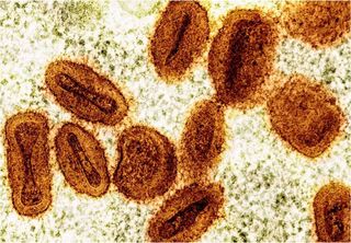 Mpox chega a SP, vírus responsável por surto na África está no Brasil; entenda a doença e como se prevenir