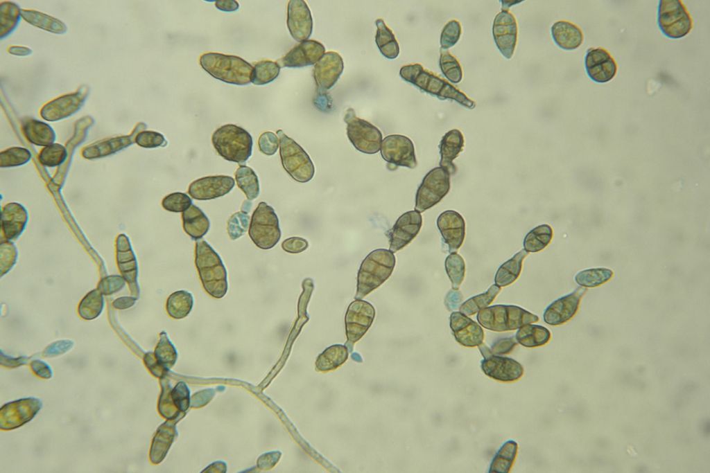 Alternaria, cebola, arroz