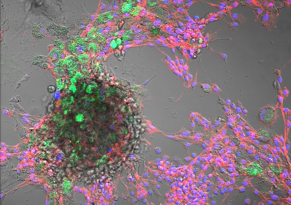 Kombinierte Hellfeld- und Fluoreszenzmikroskopie von Rinderzellen: Zellkerne (blau), Cytoskelett (rot) und aufgenommene Polystyrol-Nanoplastikpartikel (grün, 100 nm). Kombinierte Hellfeld- und Fluoreszenzmikroskopie von Rinderzellen: Zellkerne (blau), Cytoskelett (rot) und aufgenommene Polystyrol-Nanoplastikpartikel (grün, 100 nm).
