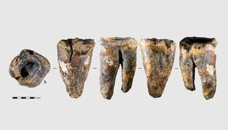 Neandertais podem ter removido c&aacute;ries com ferramentas de pedra h&aacute; 59 mil anos