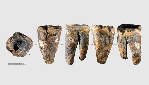 Neandertais podem ter removido c&aacute;ries com ferramentas de pedra h&aacute; 59 mil anos
