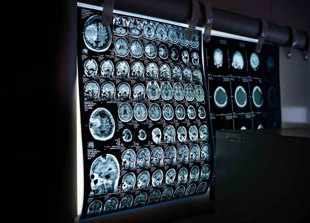 El cerebro se modifica debido al uso abusivo del smartphone. El cerebro se modifica debido al uso abusivo del smartphone.
