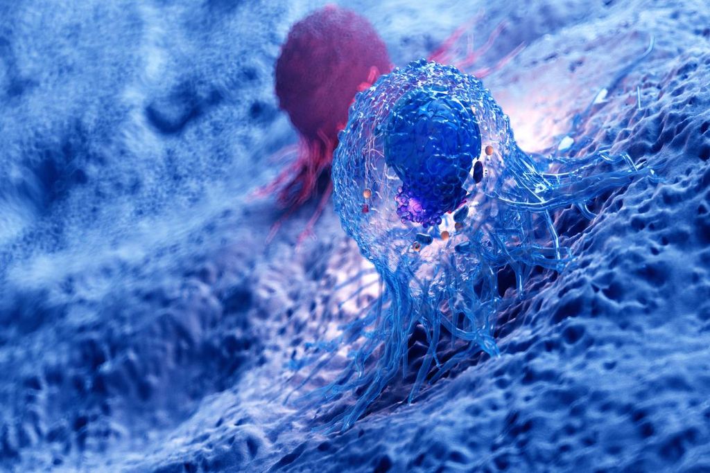 Le cancer du pancréas est le quatrième type de néoplasme le plus mortel dans les pays développés.