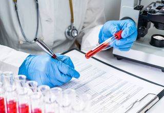 Novo exame de sangue tem 83% de precisão na detecção de câncer colorretal, diz estudo
