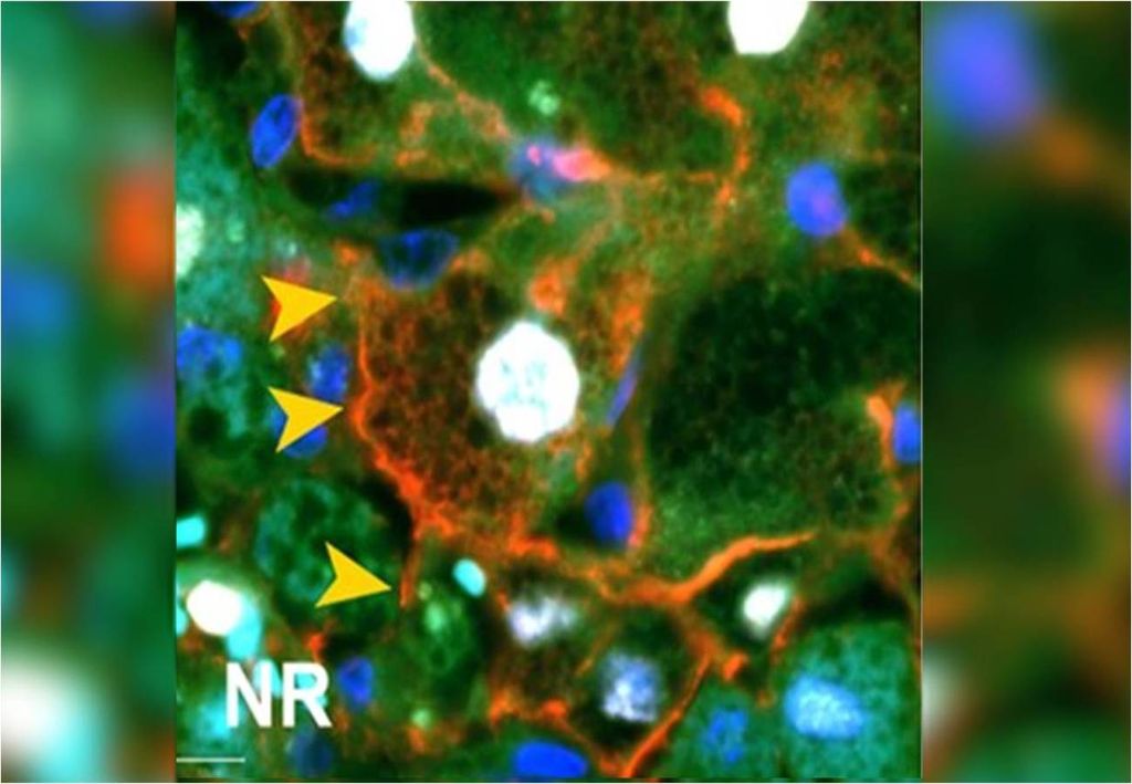 tecido hepático tecido hepático