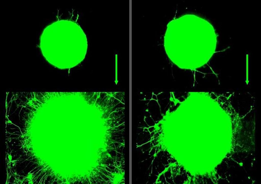 Science proves when we work out our muscles, it helps our neurons grow