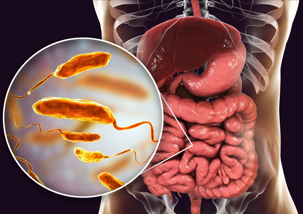 O recente caso de cólera no Brasil representa um risco para a saúde ...