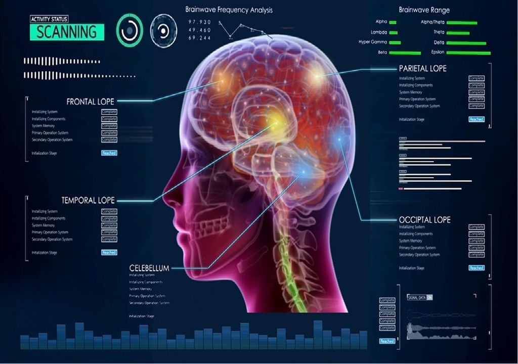 Scan da atividade cerebral Scan da atividade cerebral