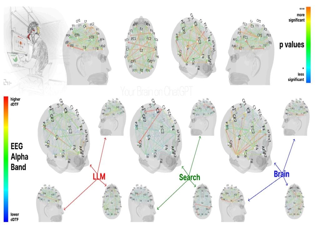 Eletroencefalogramas que monitorização da atividade cerebral Eletroencefalogramas que monitorização da atividade cerebral