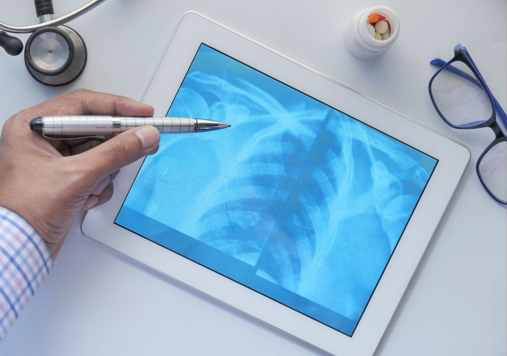 Radiografía columna