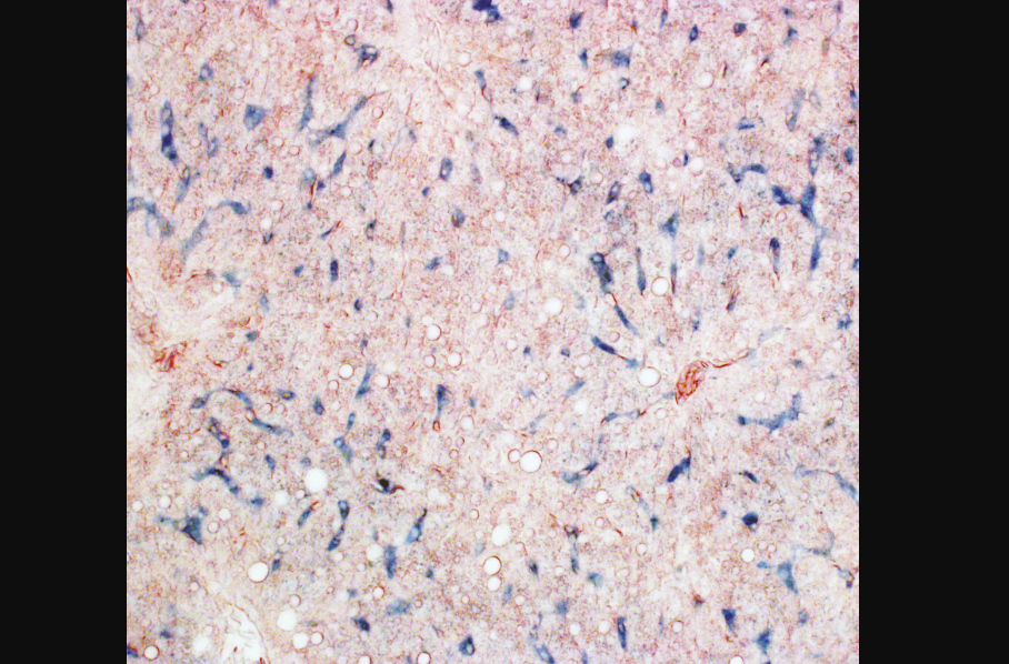 Tejido hepático de paloma que muestra macrófagos que contienen hierro (azul). © Lisowski et al. (2026) Science